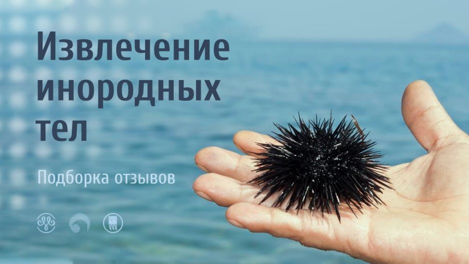 Морской еж в Средиземном море