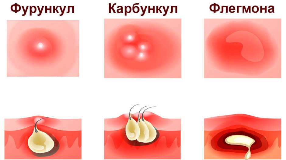 Лисы Кицунэ фенек Фокс