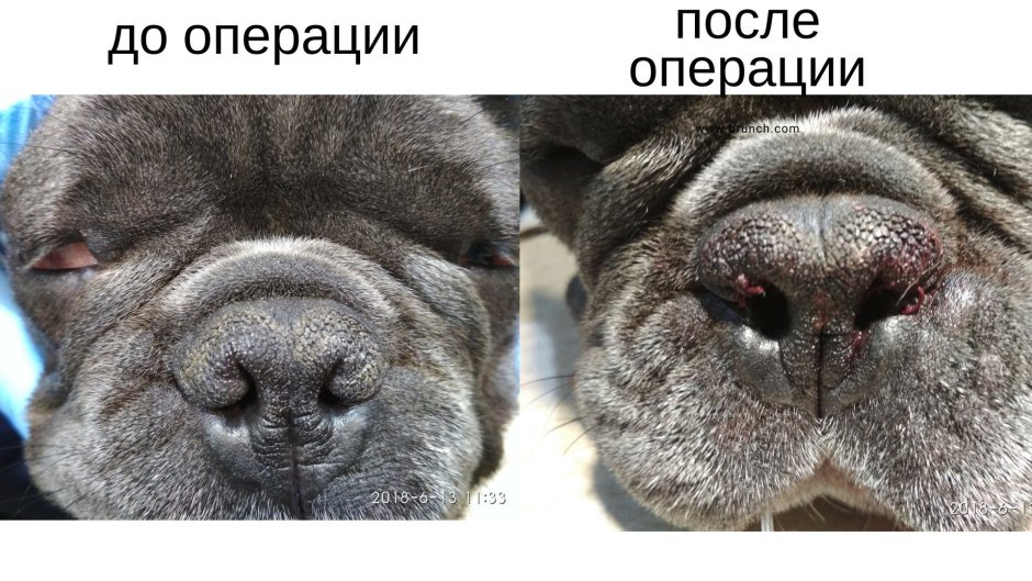 Долихо и брахицефал
