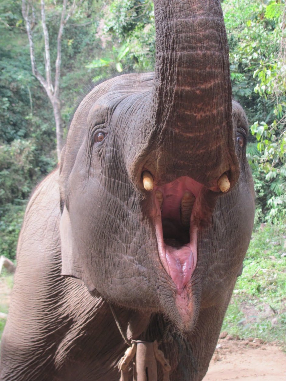 Зубной абсцесс рисунок