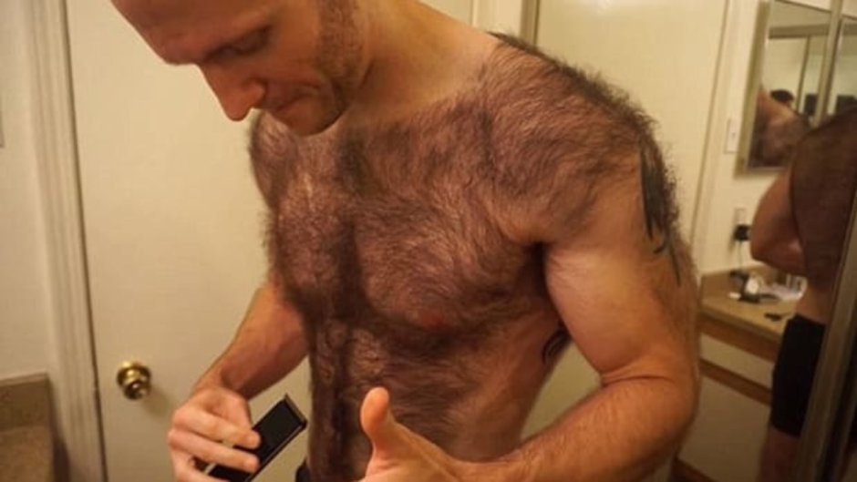 Волосы на бицепсе у мужчин