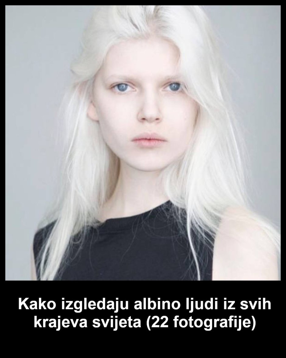 Близнецы альбиносы